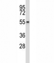 Wee2 antibody western blot analysis in HepG2 lysate.