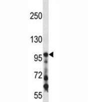 COL1A1 antibody western blot analysis in mouse kidney tissue lysate. Expected molecular weight: 140-210 kDa (precusor), 70-90 kDa (mature).