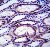 COL1A1 antibody immunohistochemistry analysis in formalin fixed and paraffin embedded human kidney tissue.