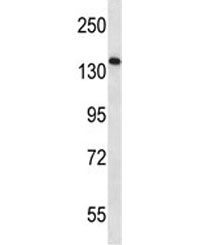 AATK antibody western blot analysis in CEM lysate