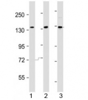 Western blot testing of AATK antibody at 1:2000 dilution. Lane 1: HeLa lysate; 2: HepG2 lysate; 3: A549 lysate; Predicted band size : 145 kDa.