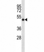 SOCS4 antibody western blot analysis in NCI-H460 lysate. Predicted/observed molecular weigth ~51kDa.
