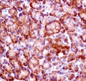 RIPK3 antibody immunohistochemistry analysis in formalin fixed and paraffin embedded human pancreas tissue.