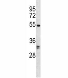 RIPK3 antibody western blot analysis in K562 lysate. Predicted molecular weight ~57 kDa.~
