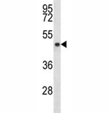 SIRT3 antibody western blot analysis in MDA-MB453 lysate. Predicted size: 44/28 kDa (full/processed)