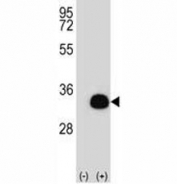 Western blot analysis of SIRT5 antibody and 293 cell lysate (2 ug/lane) either nontransfected (Lane 1) or transiently transfected (2) with the SIRT5 gene.