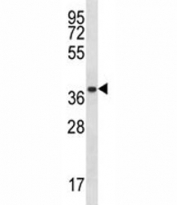 PSMA1 antibody western blot analysis in A2058 lysate. Predicted molecular weight ~30 kDa.