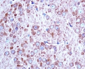 Aak1 antibody immunohistochemistry analysis in formalin fixed and paraffin embedded mouse brain tissue.