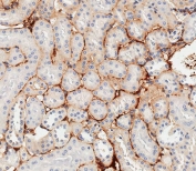 Ddr2 antibody immunohistochemistry analysis in formalin fixed and paraffin embedded mouse kidney tissue. HIER: steam section in pH6 citrate buffer for 20 min and allow to cool prior to staining.