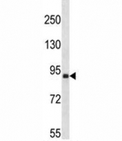 Ddr2 antibody western blot analysis in mouse bladder tissue lysate. Predicted molecular weight: 97-116 kDa.