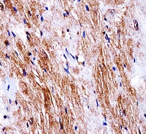 Ddr2 antibody immunohistochemistry analysis in formalin fixed and paraffin embedded mouse heart tissue.~