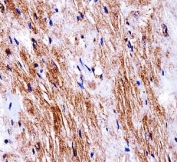 Ddr2 antibody immunohistochemistry analysis in formalin fixed and paraffin embedded mouse heart tissue.