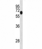 Dyrk1b antibody western blot analysis in mouse lung tissue lysate. Predicted molecular weight: 69/75 kDa (isoforms 1/3).