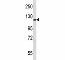 Epha2 antibody western blot analysis in mouse lung tissue lysate.