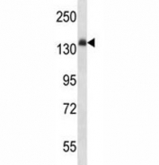 Anti-Insulin Receptor antibody western blot analysis in mouse liver tissue lysate. Expected molecular weight: ~156 kDa.