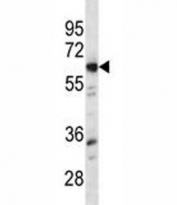Lyn antibody western blot analysis in mouse bladder tissue lysate. Predicted molecular weight ~58 kDa.