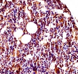 Lyn antibody immunohistochemistry analysis in formalin fixed and paraffin embedded mouse bone (femur).~