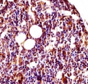 Lyn antibody immunohistochemistry analysis in formalin fixed and paraffin embedded mouse bone (femur).