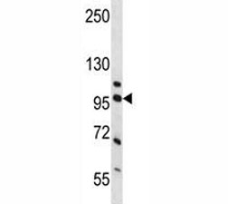 Western blot analysis of NCL and human placenta tissue lysate. Predicted molecular weight is 77 kDa, observed size is 100~110 kDa.~