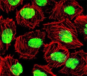 Fluorescent confocal image of U251 cell stained with NCL antibody at 1:25. NCL immunoreactivity is loca