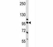 Western blot analysis of NCL and human placenta tissue lysate. Predicted molecular weight is 77 kDa, observed size is 100~110 kDa.
