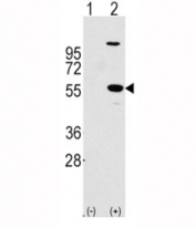 Western blot analysis of ALDH1A1 antibody and 293 cell lysate (2 ug/lane) either nontransfected (Lane 1) or transiently transfected with the ALDH1A1 gene (2).