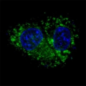 Fluorescent confocal image of HepG2 cells stained with ALDH1A1 antibody at 1:100. ALDH1A1 immunoreactivity is localized to the cytoplasm of HepG2 cells.