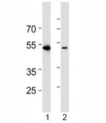 Western blot analysis of lysate from 1) HL-60 and 2) Jurkat cell line using RUNX3 antibody at 1:1000.