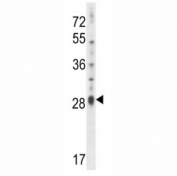 IL17D antibody western blot analysis in NCI-H460 lysate.