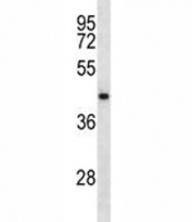 NDRG2 antibody western blot analysis in CEM lysate. Predicted molecular weight: ~41kDa.