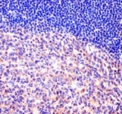 MCM6 antibody immunohistochemistry analysis in formalin fixed and paraffin embedded human tonsil tissue.