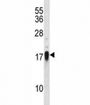 CD70 antibody western blot analysis in NCI-H460 lysate