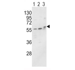 Western blot analysis of ALP / Alkaline Phosphatase antibody and MCF-7 (lane 1), HL-60 cell line (2) and mouse brain tissue (3) lysate. Predicted size 60-70 kDa