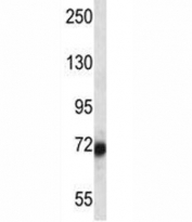 SP100 antibody western blot analysis in ZR-75-1 lysate.
