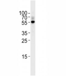 TGF Beta 2 antibody western blot analysis in Raji lysate. Predicted molecular weight ~50 kDa~