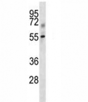 Tgfbr1 antibody western blot analysis in mouse kidney tissue lysate. Predicted molecular weight: ~55kDa.