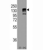 Western blot analysis of CDH1/ E Cadherin antibody and 293 cell lysate (2 ug/lane) either nontransfected (Lane 1) or transiently transfected with the CDH1 gene (2). Expected molecular weight: 135 kDa (precursor), 80-120 kDa (mature, depending on gylcosylation level).