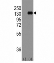 Western blot analysis of anti-E Cadherin antibody and 293 cell lysate (2 ug/lane) either nontransfected (Lane 1) or transiently transfected with the CDH1 gene (2). Expected molecular weight: 135 kDa (precursor), 80-120 kDa (mature, depending on gylcosylation level).