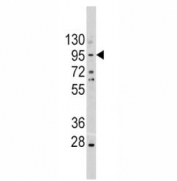 Western blot analysis of anti-E Cadherin antibody and A375 lysate. Expected molecular weight: 135 kDa (precursor), 80-120 kDa (mature, depending on gylcosylation level).
