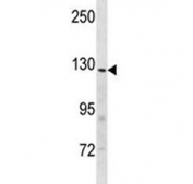 Insulin receptor R antibody western blot analysis in mouse heart tissue lysate. Expected molecular weight: ~80 kDa, 144 kDa.