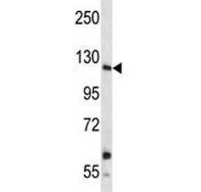 Insulin receptor R antibody western blot analysis in A549 lysate. Expected size: ~80 kDa, 144 kDa~