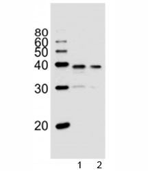 Western blot analysis of lysate from 1) PC3, and 2) LNCaP cell line using VDR antibody at 1:1000. Predicted molecular weight 48/54 kDa (isoforms 1/2).~