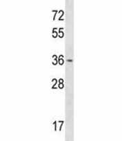 OTX1 antibody western blot analysis in T47D lysate.