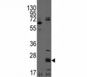 Western blot analysis of CD9 antibody and 293 cell lysate (2 ug/lane) either nontransfected (Lane 1) or transiently transfected with the CD9 gene (2).