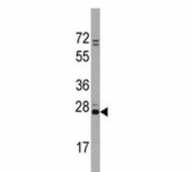 Western blot analysis of CD9 antibody and Jurkat lysate.  Predicted molecular weight is 23-27 kDa