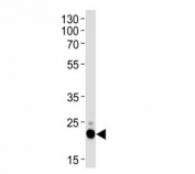 Western blot analysis of lysate from HeLa cell line using CD9 antibody.