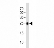 Western blot analysis of lysate from mouse kidney tissue lysate using CD9 antibody.