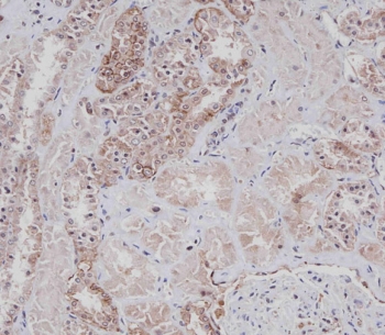 IHC staining of FFPE human kidney with CD9 antibody. HIER: boil tissue sections in pH 9 EDTA for 20 min and allow to cool before testing.
