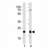 Western blot analysis of lysate from (1) HeLa and (2) MCF-7 cell line using CD9 antibody at 1:1000. Predicted molecular weight is 23-27 kDa.