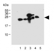 Western blot testing of human 1) RPMI-8226, 2) HCT-116, 3) MCF-7, 4) HeLa and 5) rat lung lysate with CD9 antibody. Predicted molecular weight is 23-27 kDa.